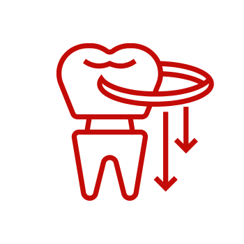 Dental Crown and Bridge Illustration