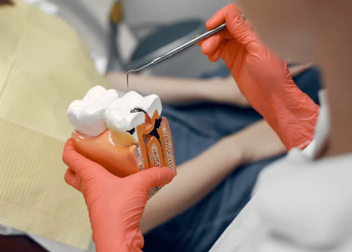 Dental Fillings