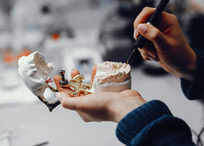 Dental Implants