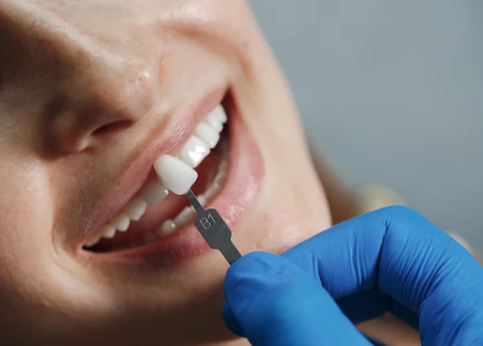Cosmetic Dentistry